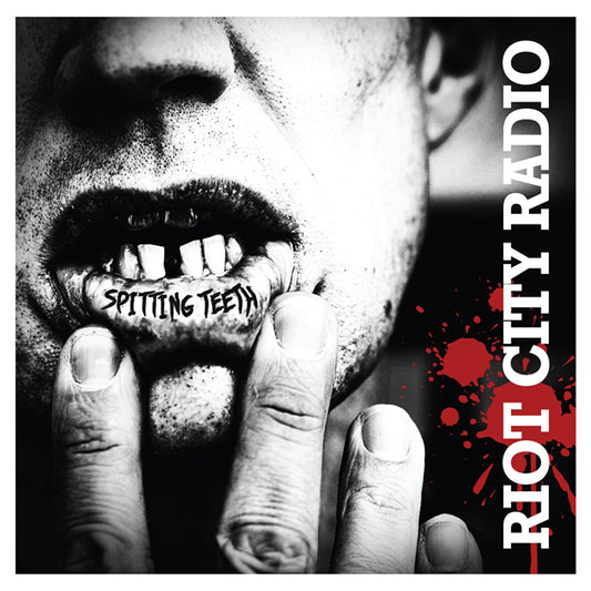 Riot City Radio - Spitting Teeth (Ltd Black Vinyl) - Punk - LP