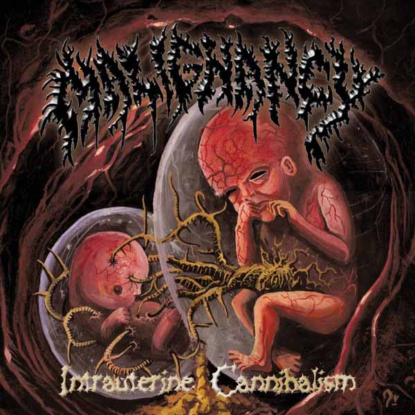 Malignancy - Intrauterine Cannibalism (Oxblood/White/Black Marbled Vinyl) - Death Metal - LP
